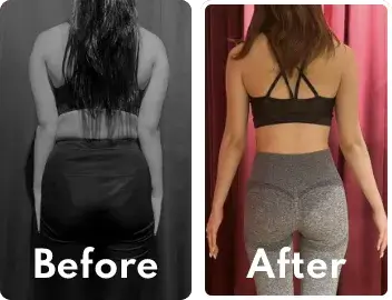 Before/After